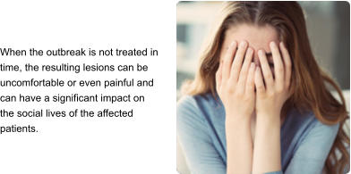When the outbreak is not treated in time, the resulting lesions can be uncomfortable or even painful and can have a significant impact on the social lives of the affected patients.