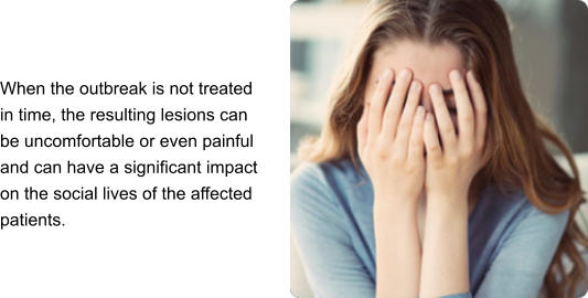 When the outbreak is not treated in time, the resulting lesions can be uncomfortable or even painful and can have a significant impact on the social lives of the affected patients.